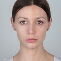 Camouflage Make-up to Hide All Your Skin Imperfections