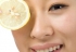 Acne – Getting Rid Of Acne Scars